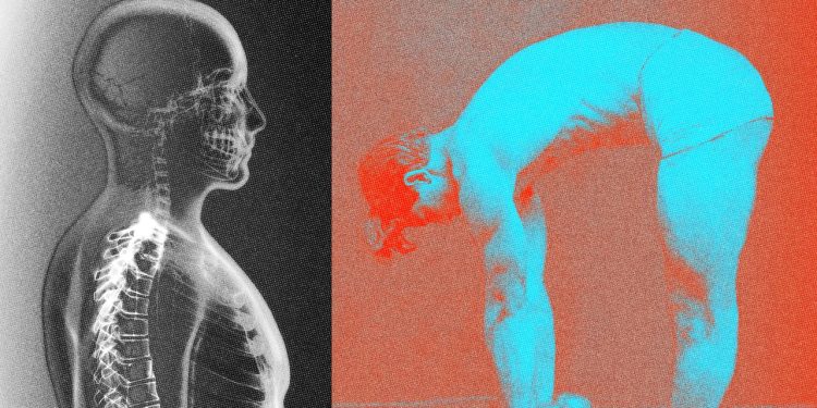 Diese Rückenübungen stärken Haltung und Muskulatur